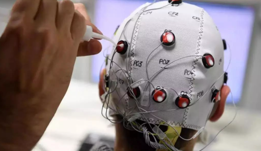 博拓生物：2026年营收有望重回增长，战略布局脑机接口未来可期