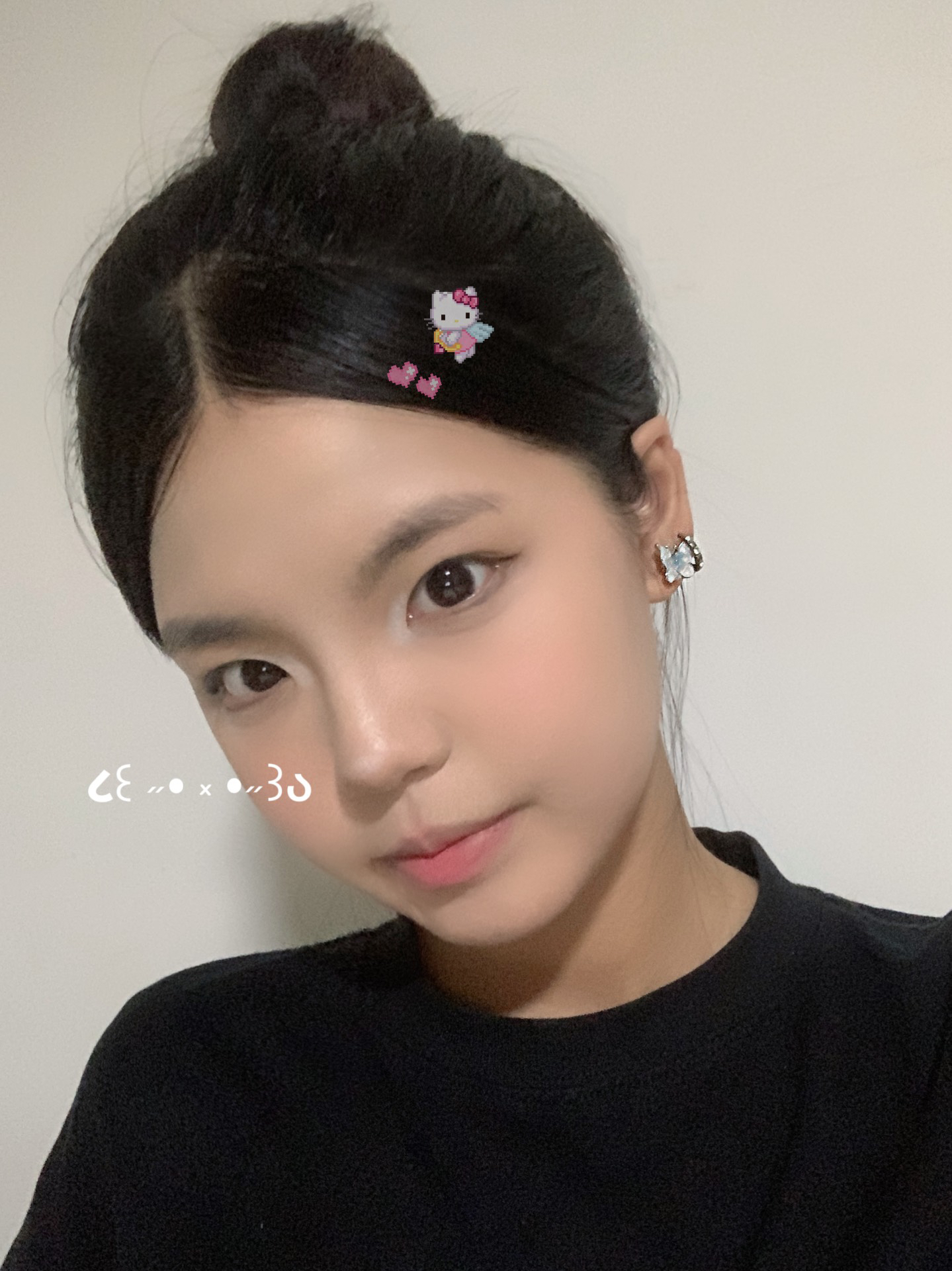 “麻药一过，生不如死”，央视曝光“精灵耳”整形乱象！一女子注射后完全面瘫，错过最佳抢救时间，神经功能恢复渺茫